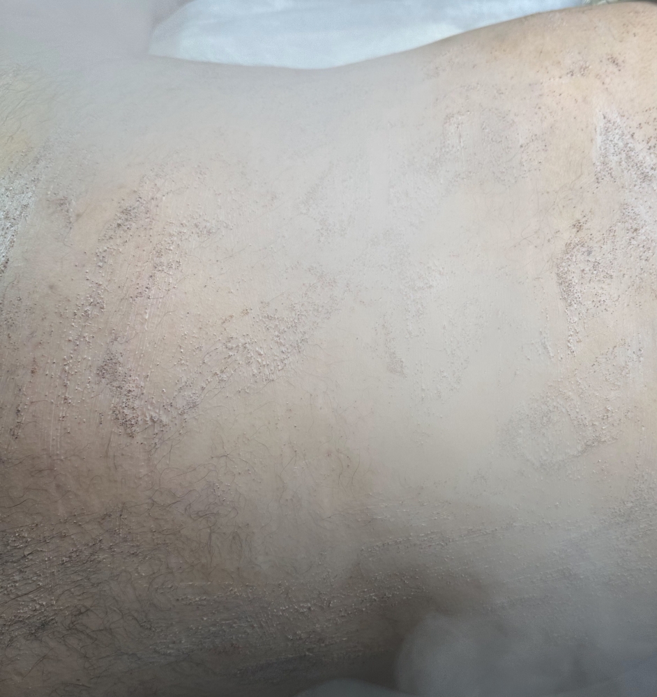 Back Facial