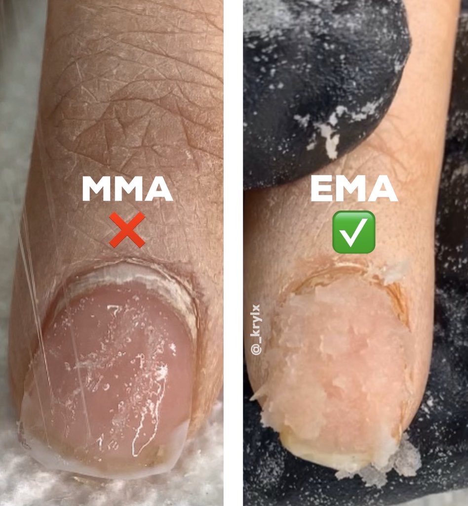 Soak Off MMA nail Removal