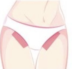 Wax Bikini Line