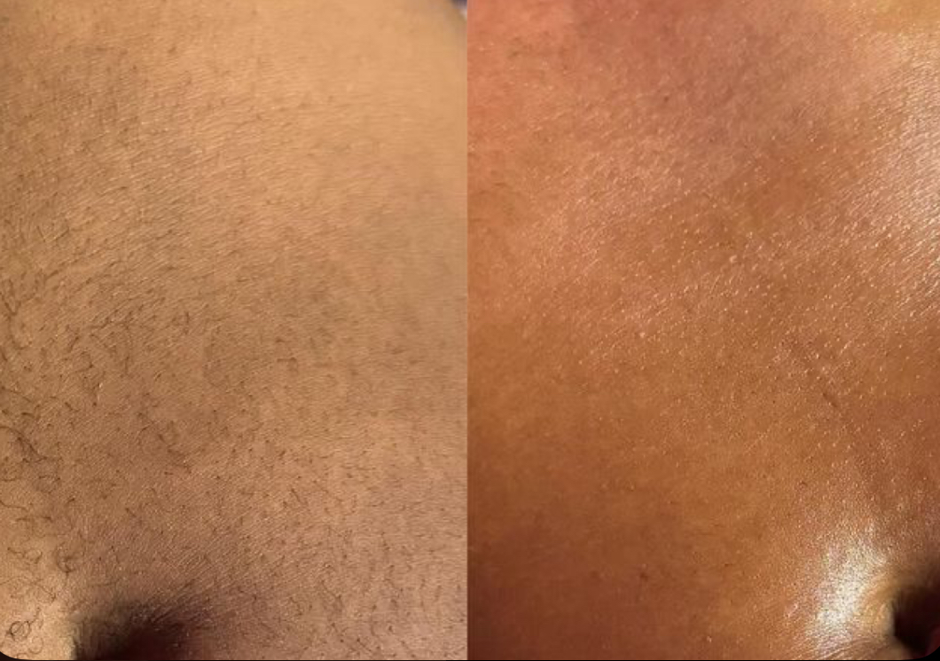 Stomach Wax at Jontahontas’ Collection LLC. in Greenville, SC