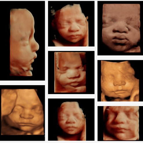 Add-On Color Print Sheet at Rancho Cucamonga 3D 4D Ultrasound by 4D Special Delivery in Rancho Cucamonga, CA