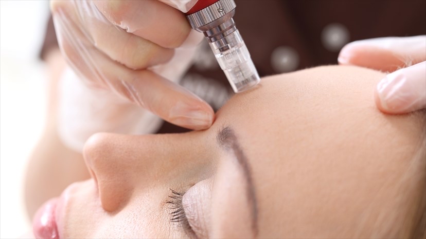 Microneedling Facials