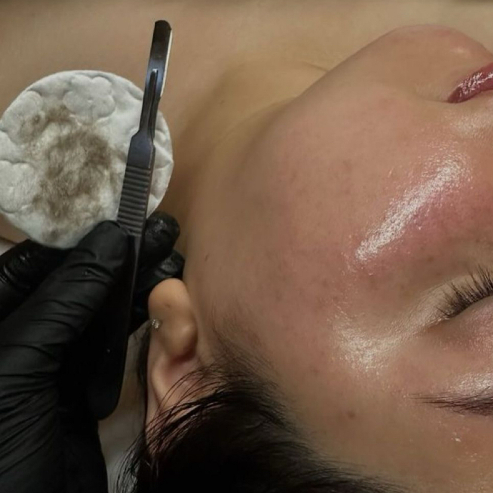 Dermaplane - ADD ON at The Esthetician Lab in West Chester, OH