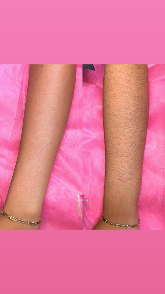 Full Arm