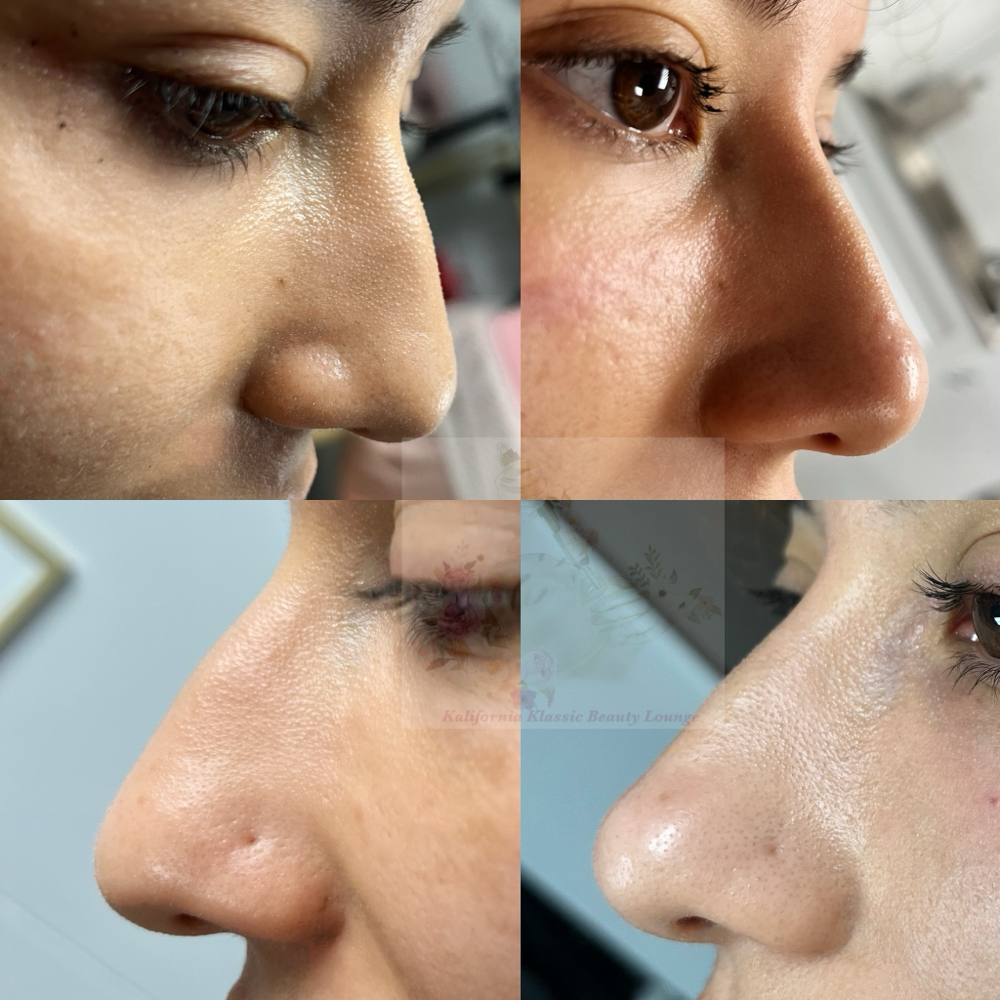 Hya LNJ at Kalifornia Klassic Beauty Lounge in Warr Acres, OK