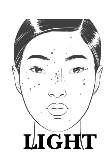 Freckles -Light coverage