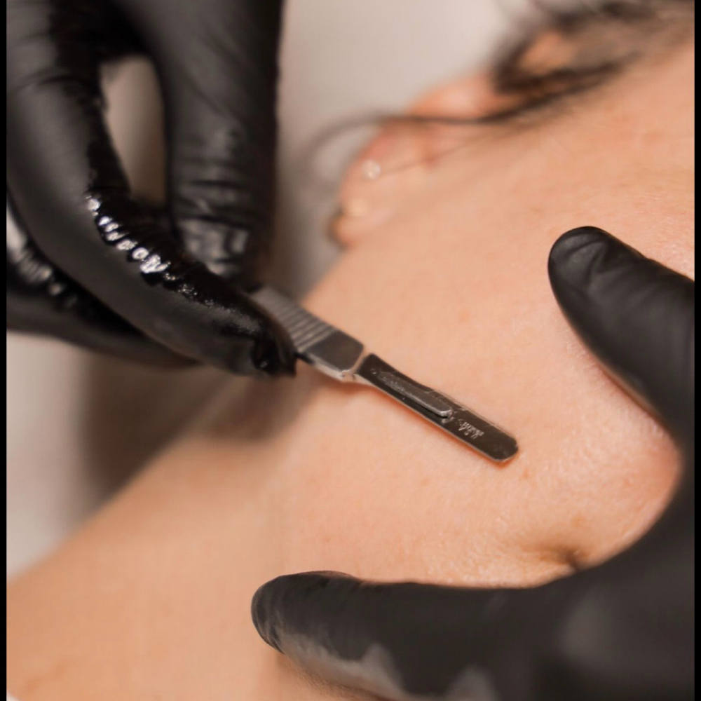 Dermaplane Model at Skin Haven Esthetics in Fort Atkinson, WI