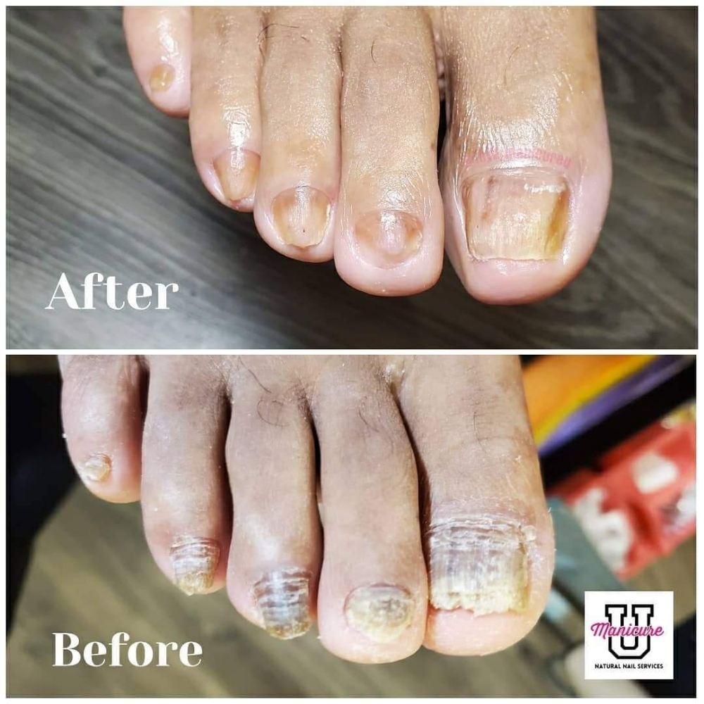 Restorative Pedicure