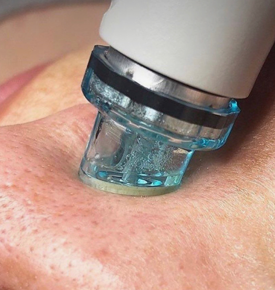 Aqua Lab Hydrafacial Revive Single