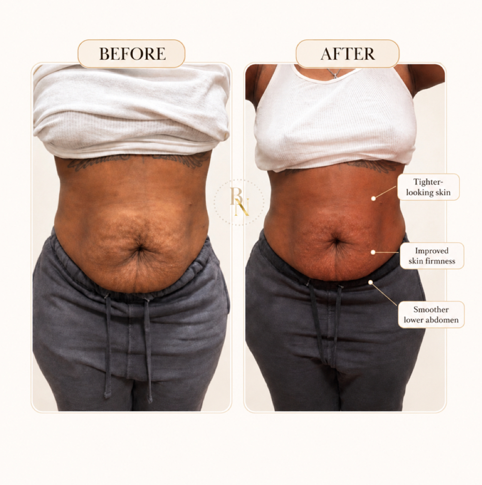 STANDARD STARTER SCULPT PACKAGE at BODIEDBYNICKEI LLC in The Bronx, NY
