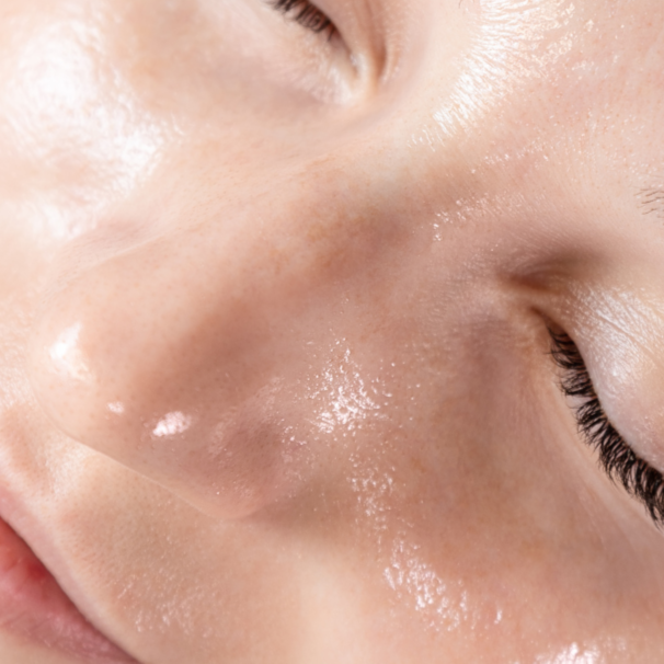 PLASMA INFUSION,TIGHTENING, FIRMING at Inner Glow Skin Care in Conifer, CO