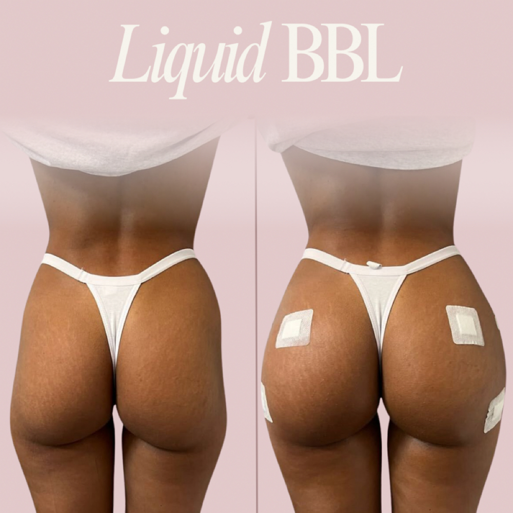 Liquid BBL at Aesthetics by Amina in New York, NY