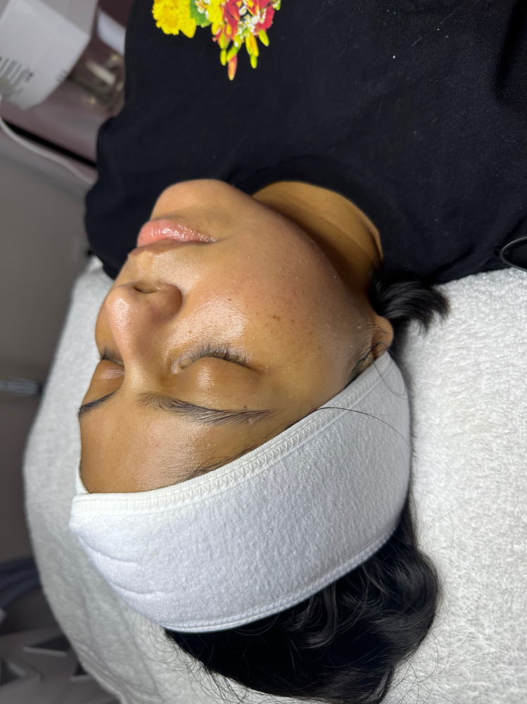 Customized Facial