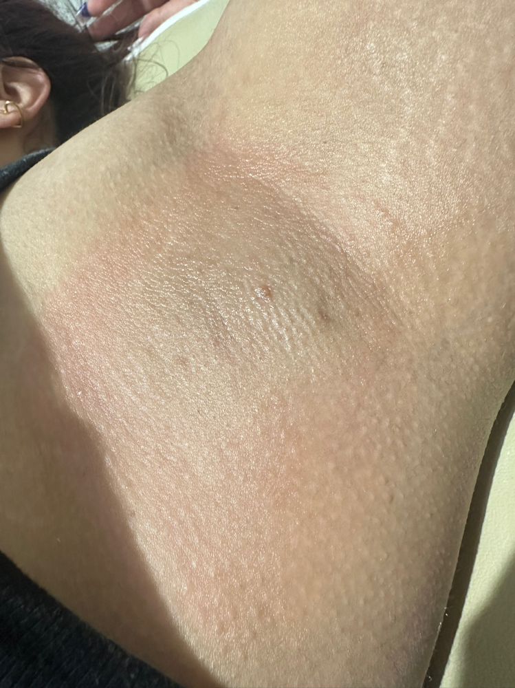 Underarm Wax