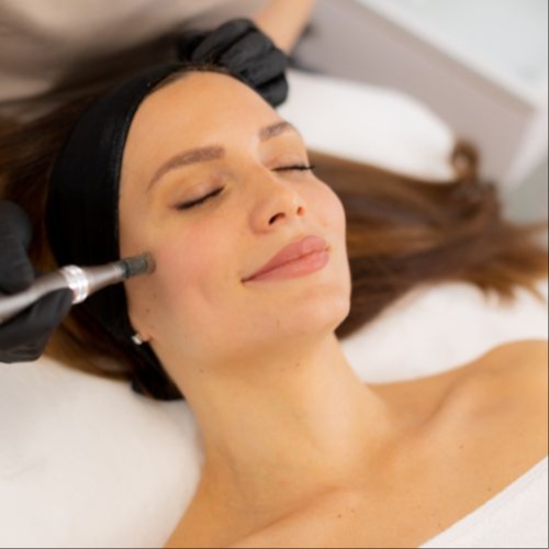 Microneedling + PDRN + LED at GEM Beauty Bar in Cottonwood, AZ