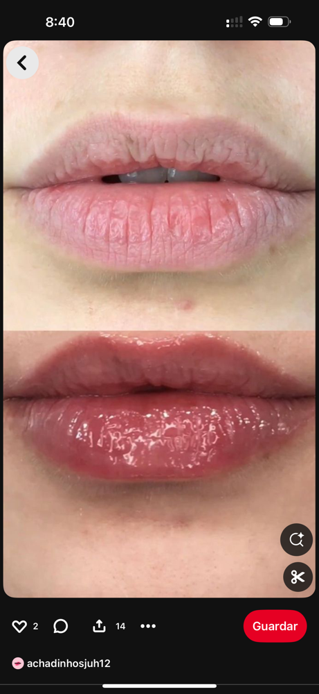 Lip Hydration