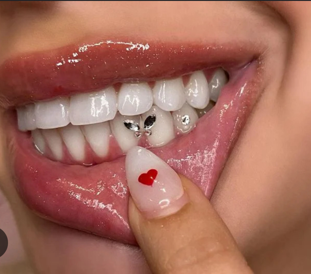Tooth Gems!