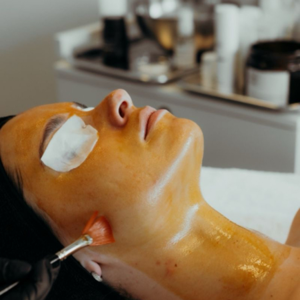 Customized Chemical Peel at Skin Theory-Katie in Perry, FL
