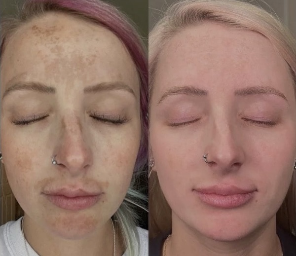 Elaine Brennan Get Glowing Peel