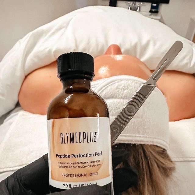 Chemical Peel Neck + Chest Add On