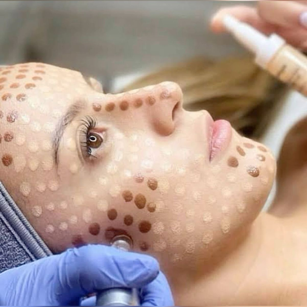 BB GLOW TREATMENT