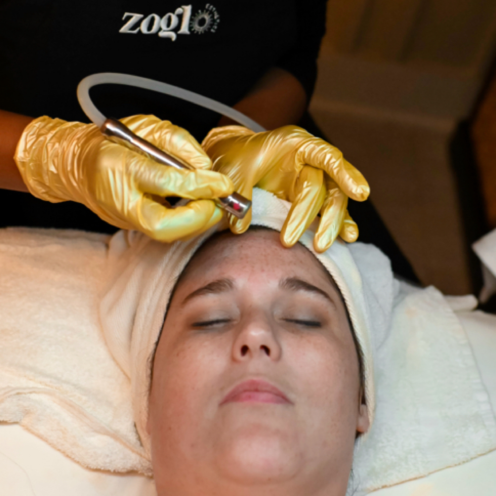 ENHANCEMENT: Microdermabrasion at ZoGlo Esthetics in Goose Creek, SC