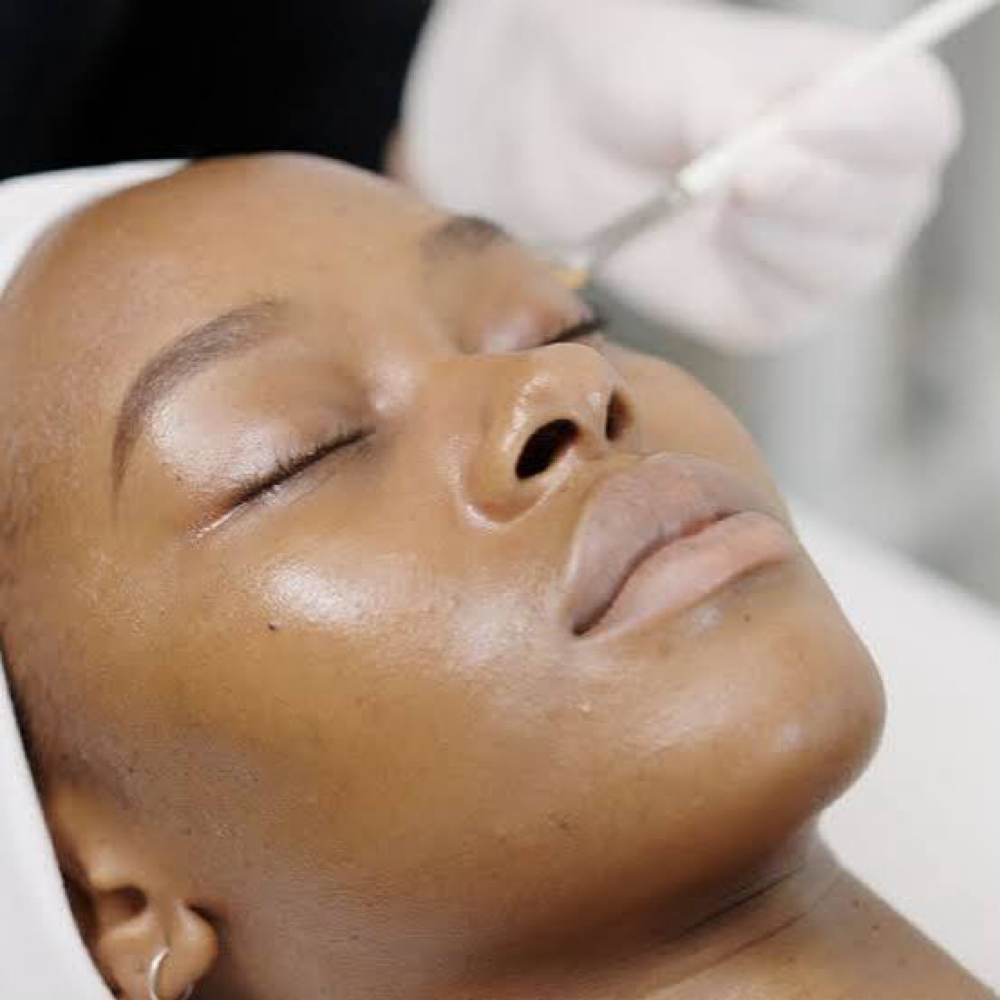 Brighter Skin Peel at Haus of Beauty Studio in Hialeah, FL