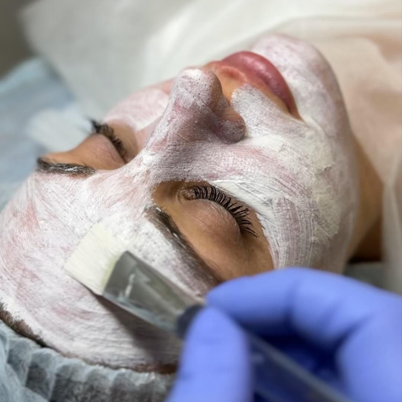 Post-Acne Facial at Anastacia Beauty Lounge in Lake Park, FL