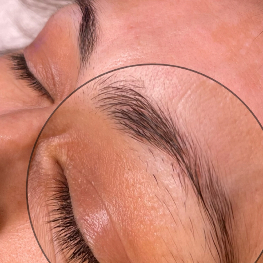 Brow Hair Growth Microneedling