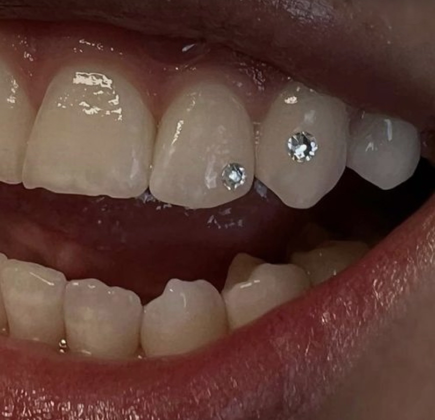 Tooth Gem Add On