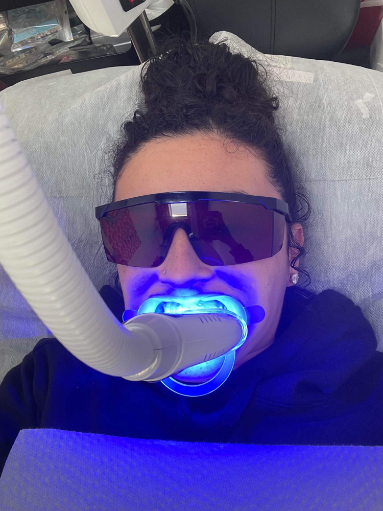 Teeth Whitening at Andreas Beauty Lab in Brooklyn, NY