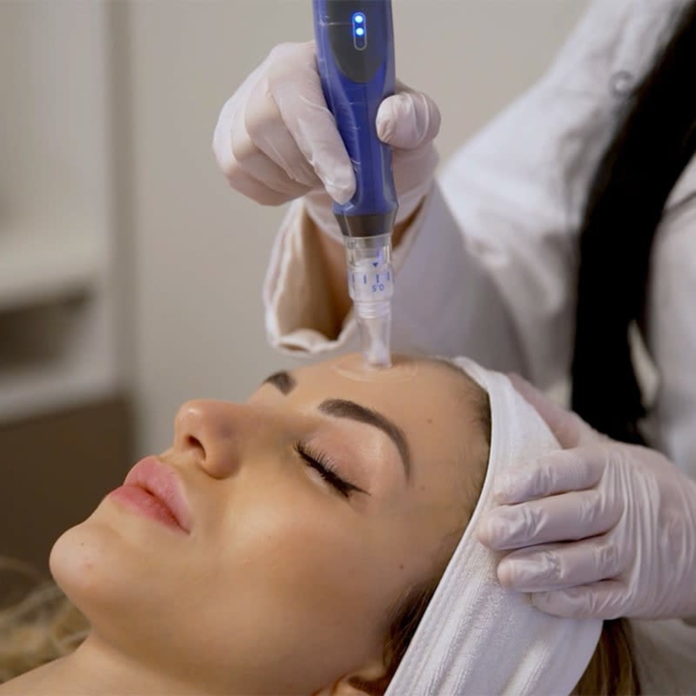Skin Pen Microneedling