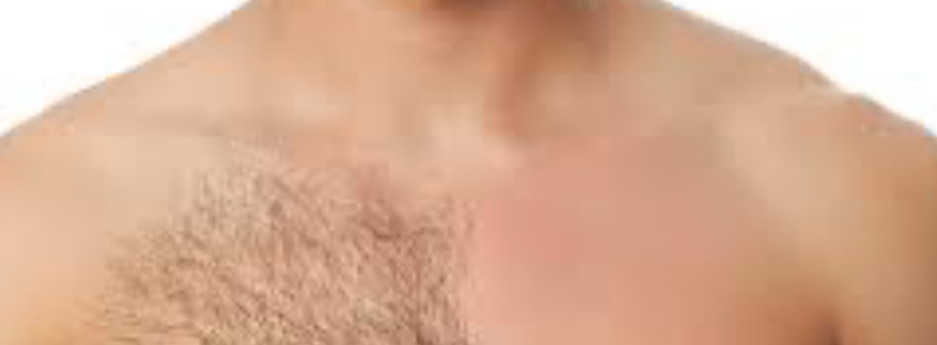 Full Chest Wax