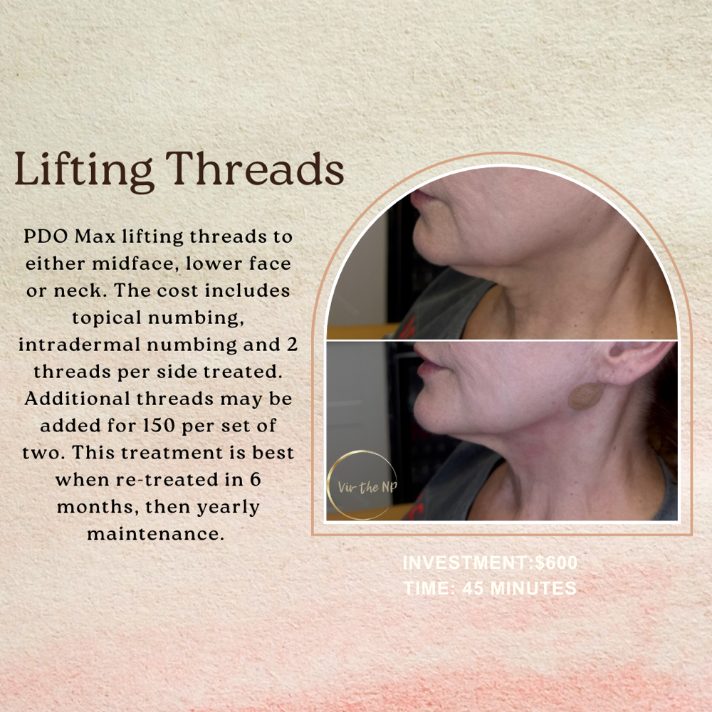 PDO Threads