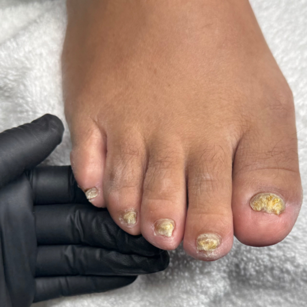 Extreme Fungal Wellness Pedi at Dessys Nail Cave in Houston, TX
