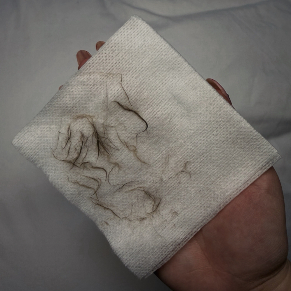 Dermaplane Only at Skin by Tins in Greer, SC