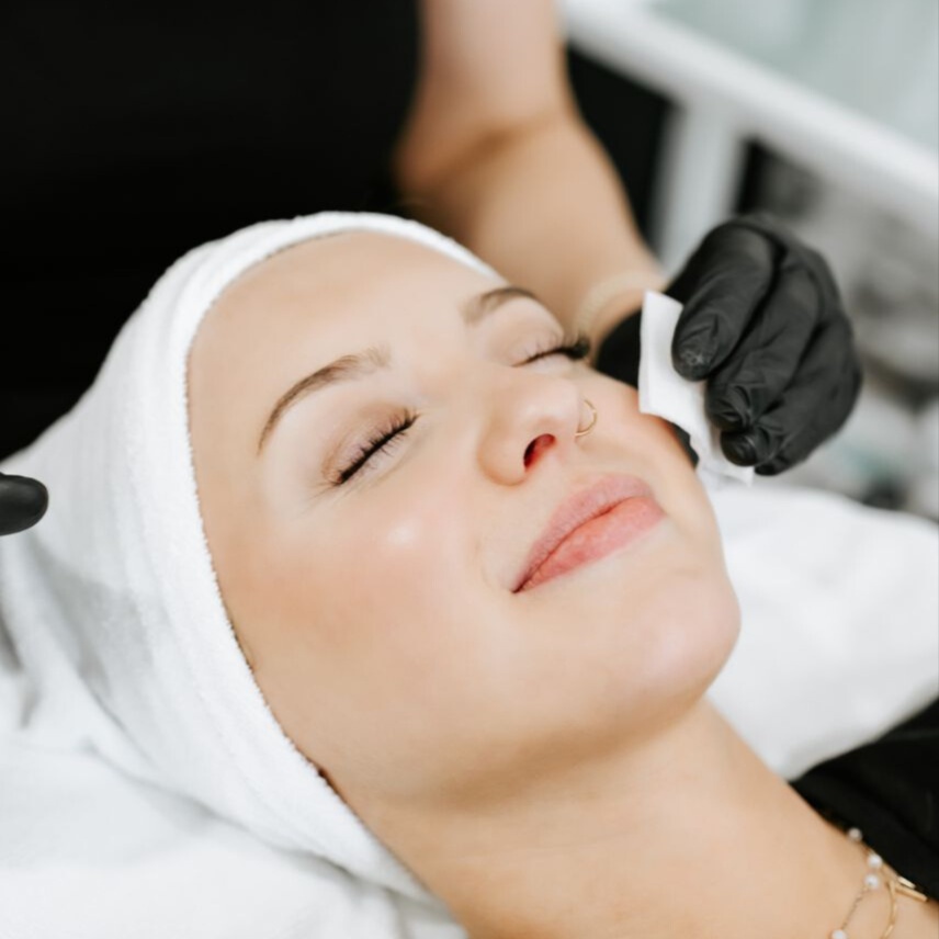 Targeted Chemical Peel Treatment