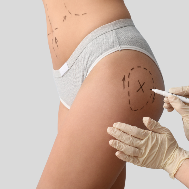 Manual Lymph Drainage-Post Surgery