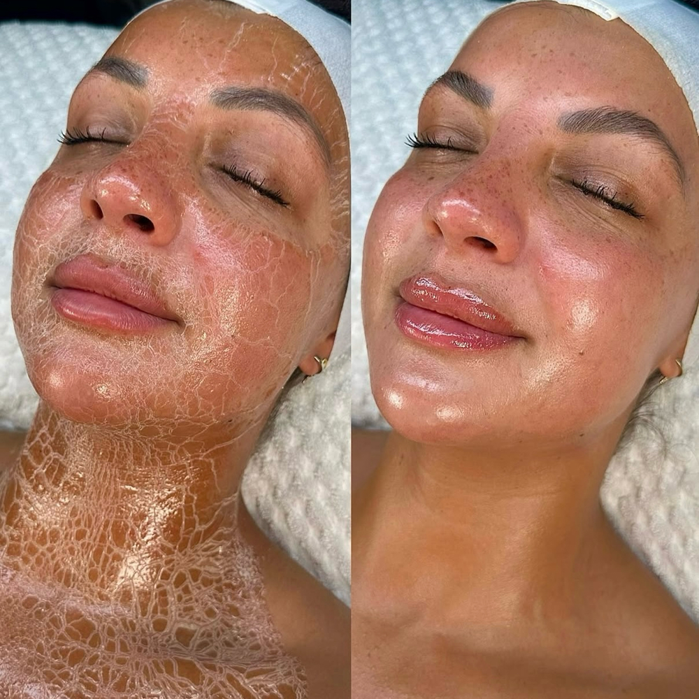 Ultimate Anti-Aging Facial