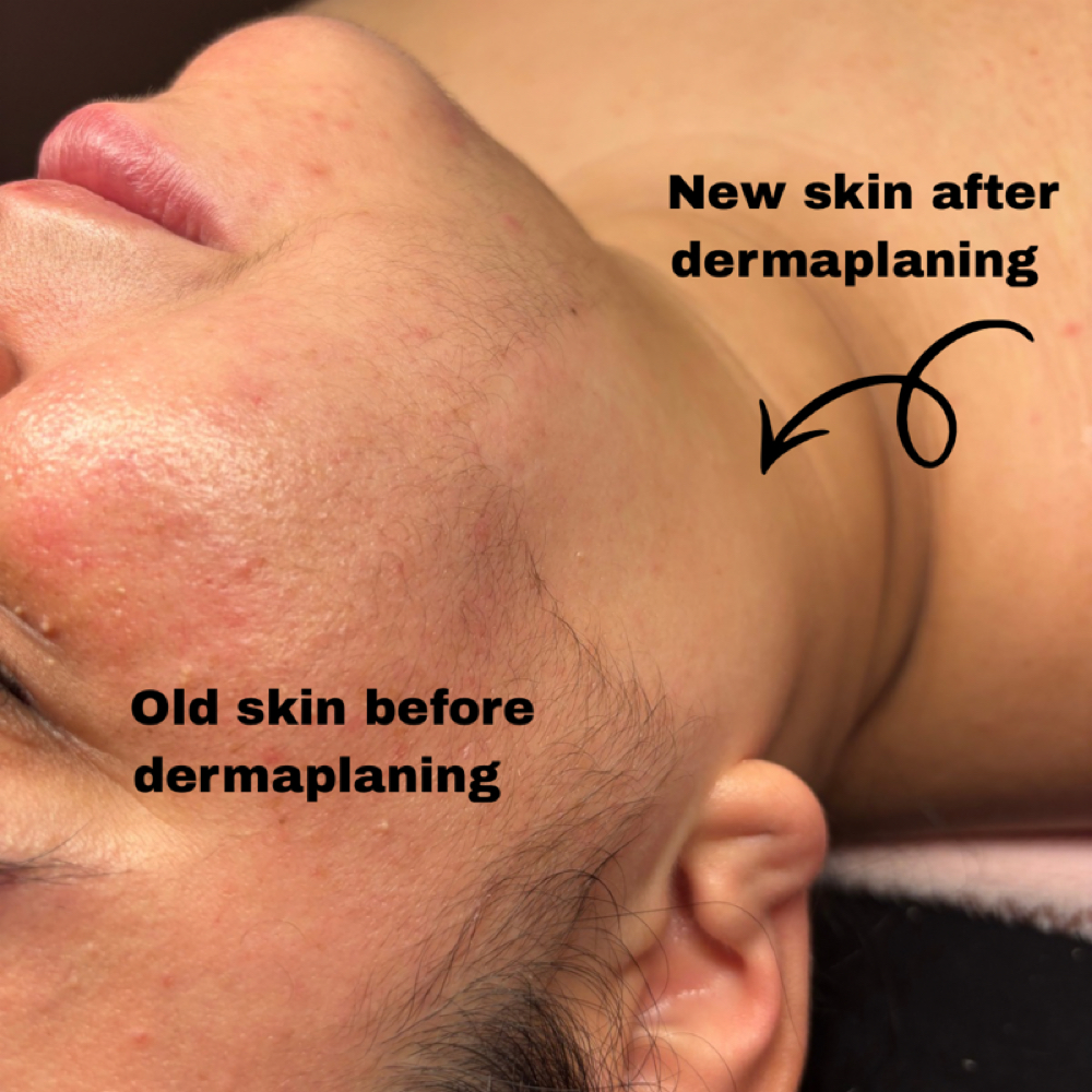 Dermaplaning Add On at Bre & Me Esthetics in Delaware, OH