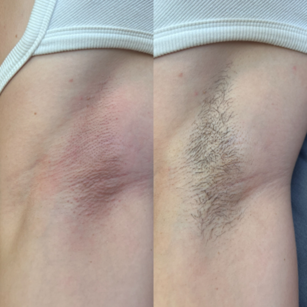 Underarm Wax at american.beauty hair studio in Diamond Springs, CA