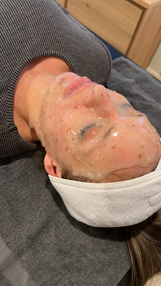 Chemical Peel at Mirada Esthetics in Franklin, TN