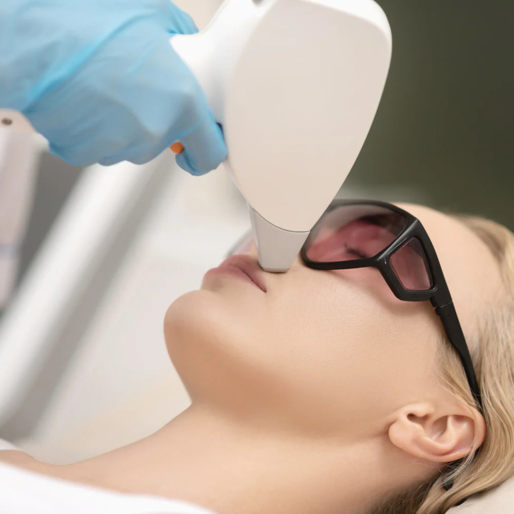 Diodo Laser (bigote) at Diana Bella LLC in Deerfield Beach, FL