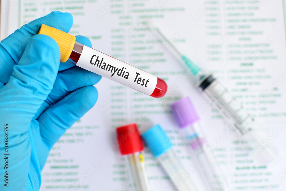 CHLAMYDIA PANEL