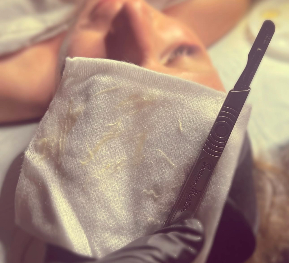 Dermaplane Add On