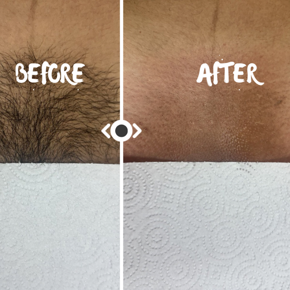 Brazilian Wax at Secret Garden Waxing in Watauga, TX