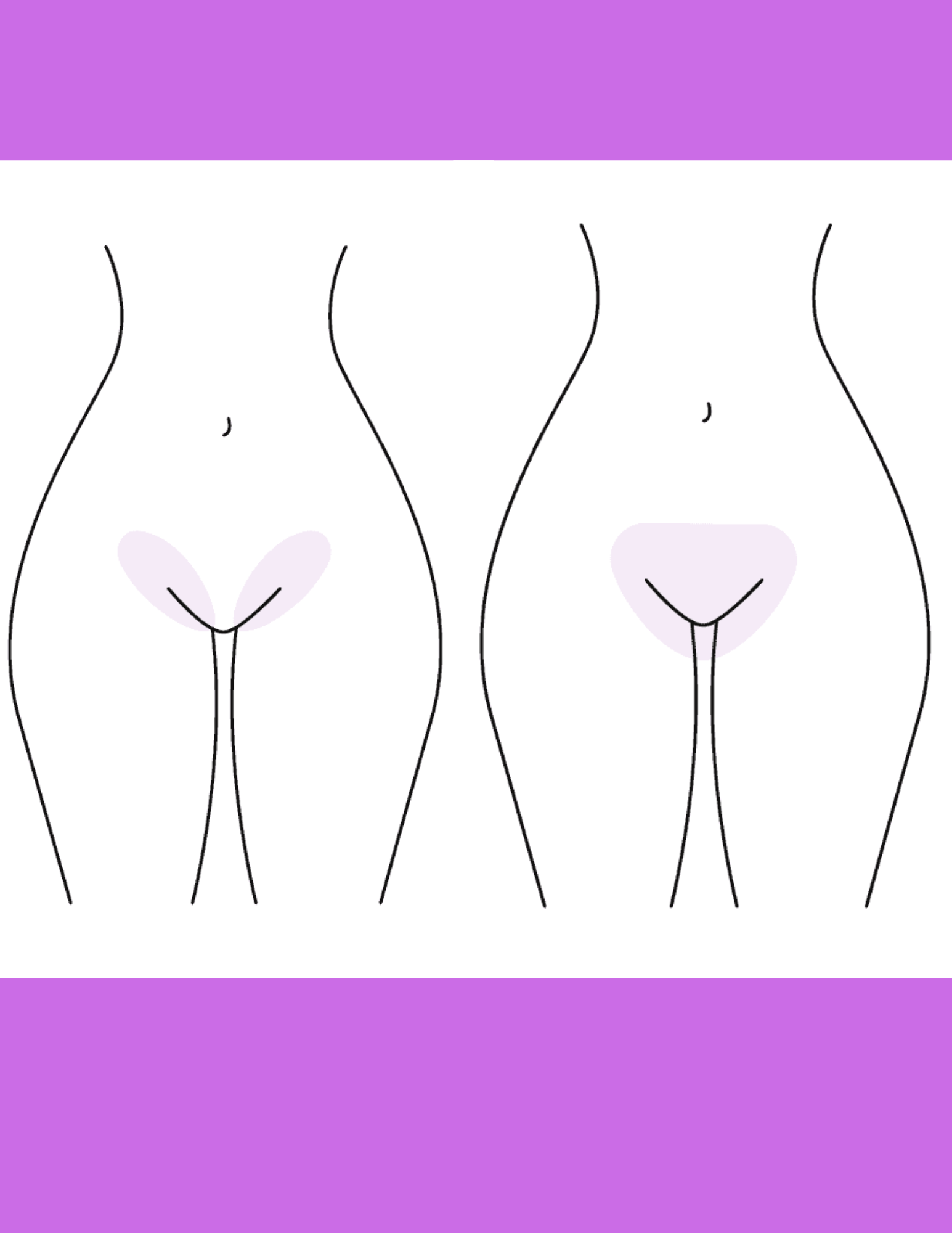 Bikini Front + Gift [NEW CLIENT]