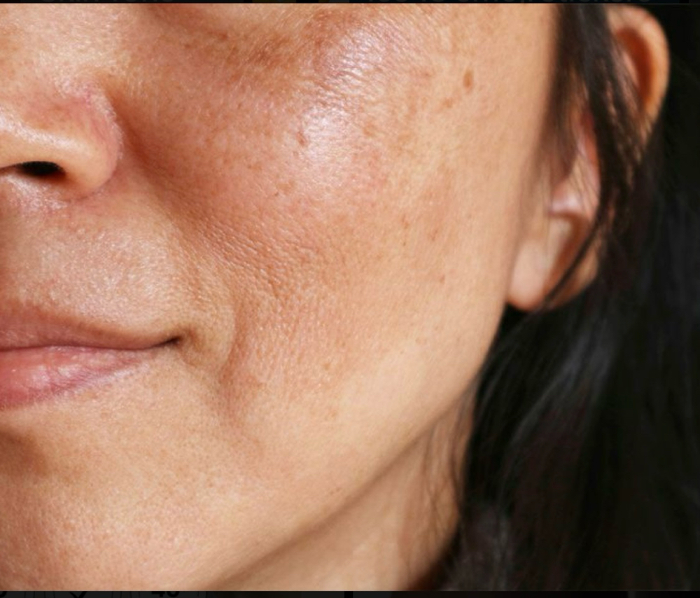 Cold Peel