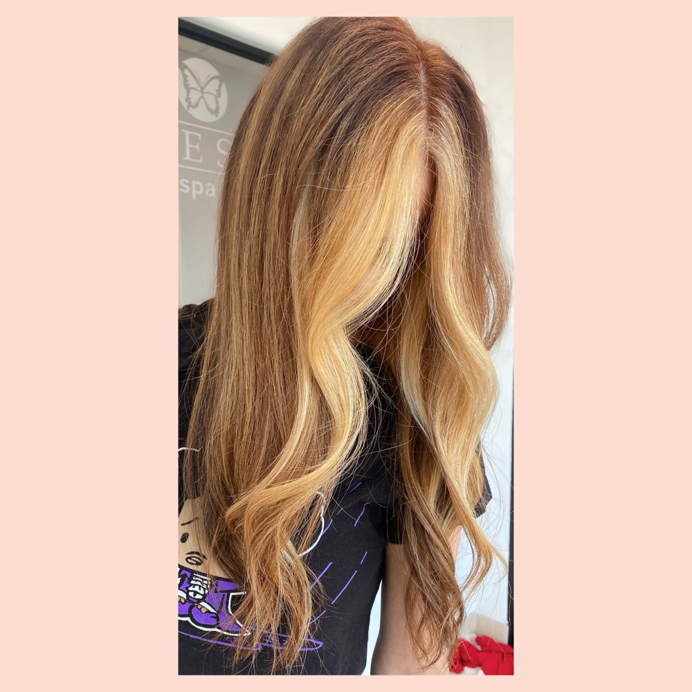 Gray Root Coverage