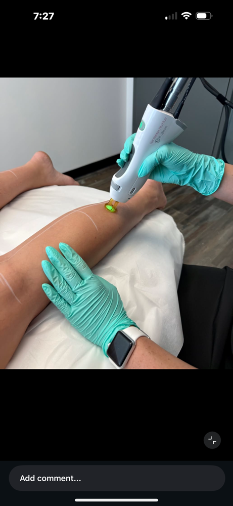 Extra Large Laser Area